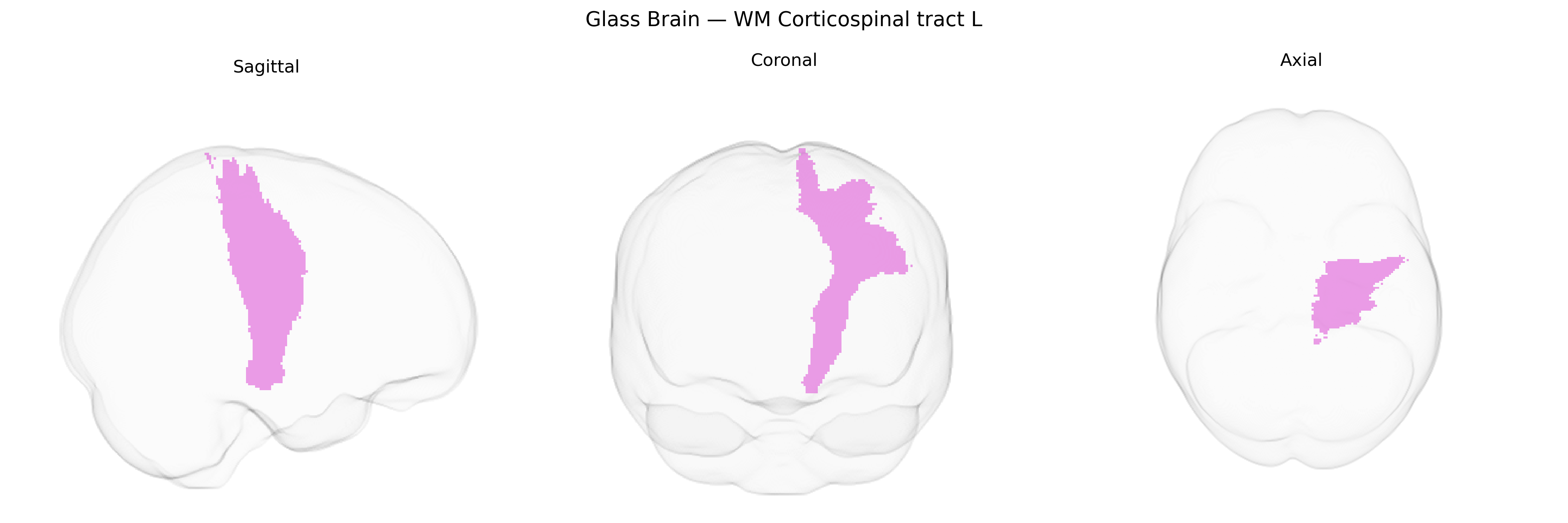 Triplanar Ghost Brain