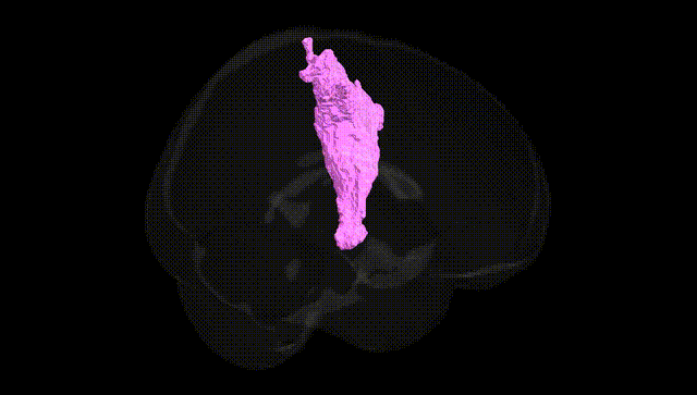 Full Brain Black