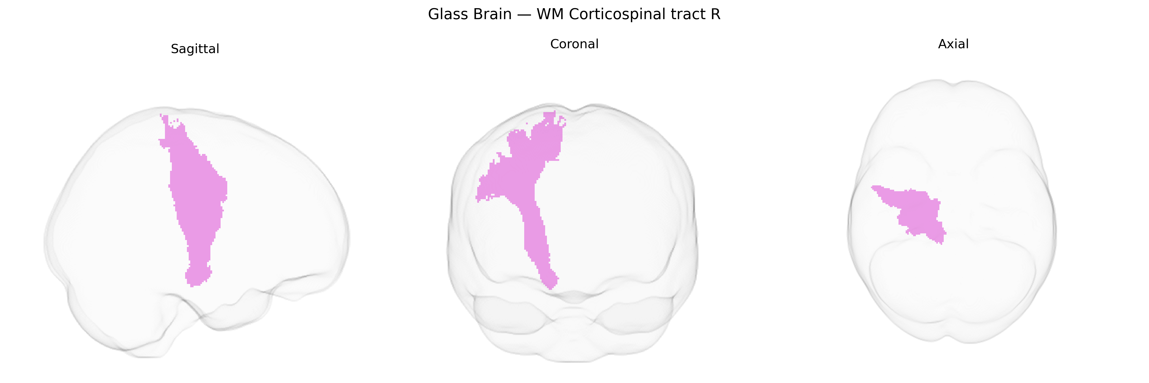 Triplanar Ghost Brain