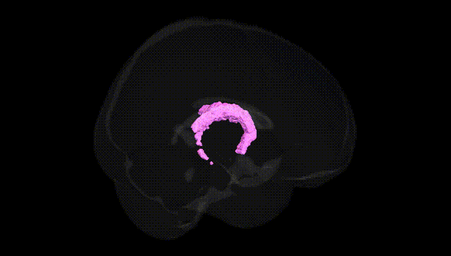 Full Brain Black