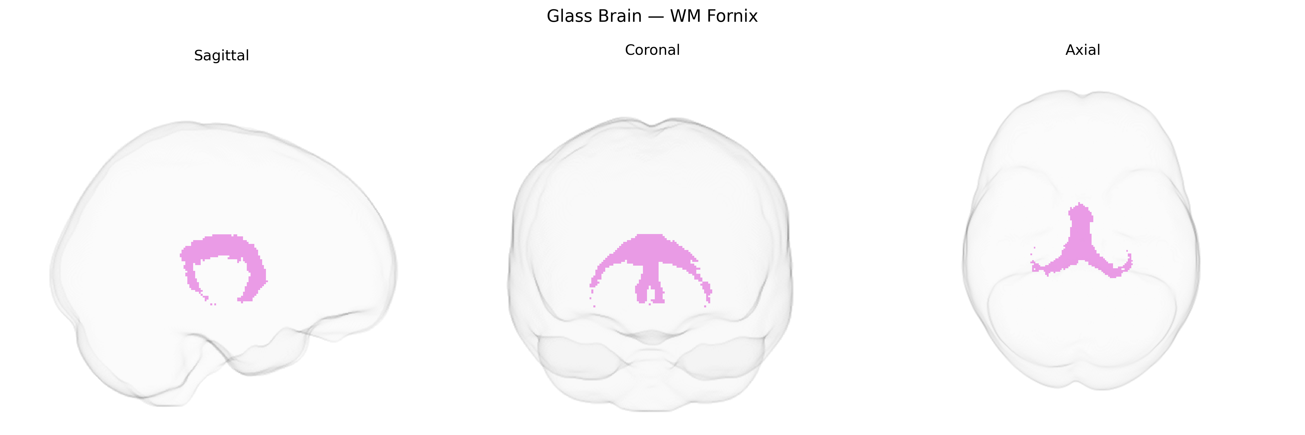 Triplanar Ghost Brain