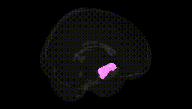 Full Brain Black