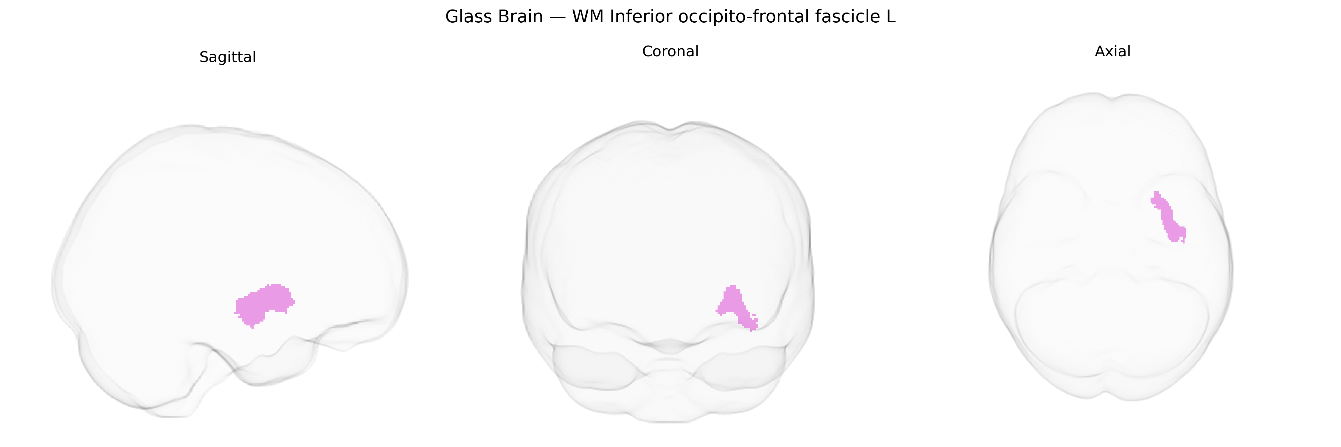 Triplanar Ghost Brain