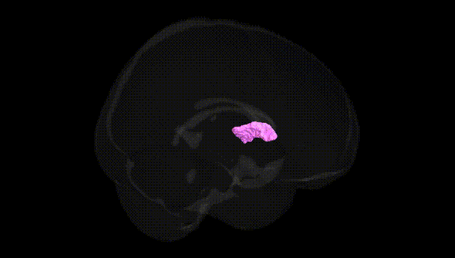 Full Brain Black