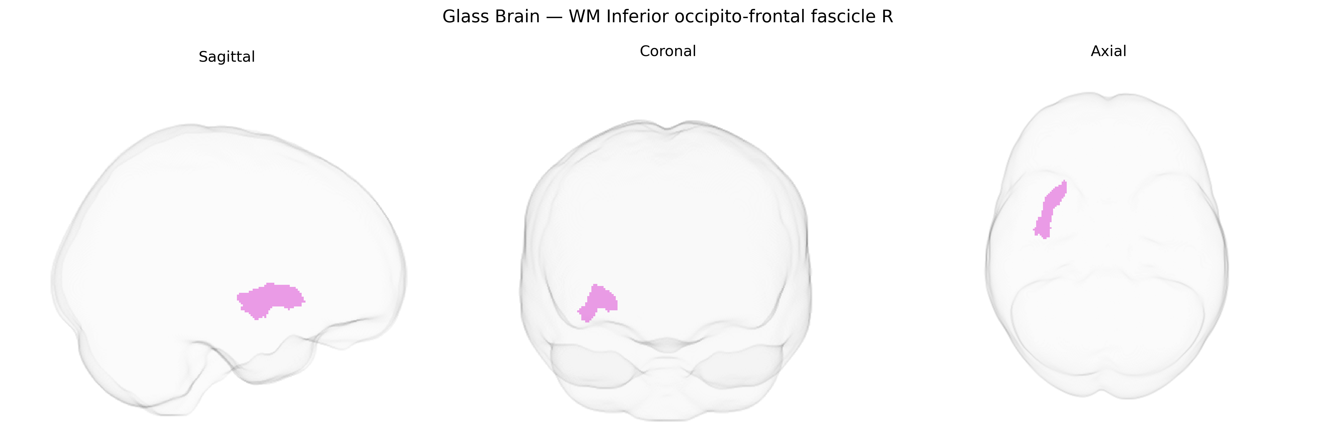 Triplanar Ghost Brain