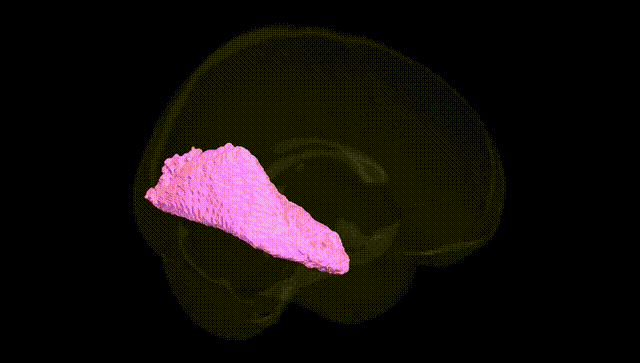 Full Brain Black