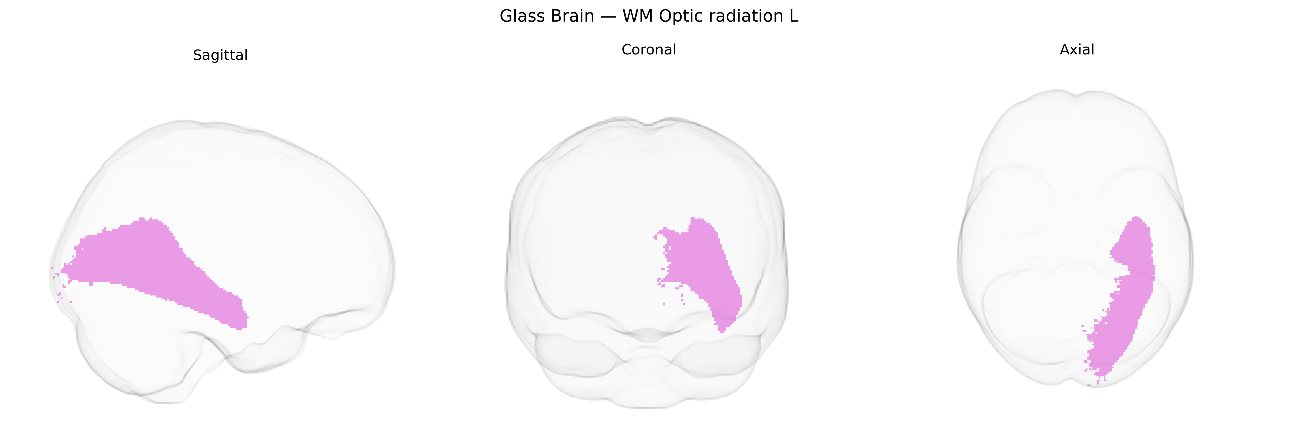Triplanar Ghost Brain