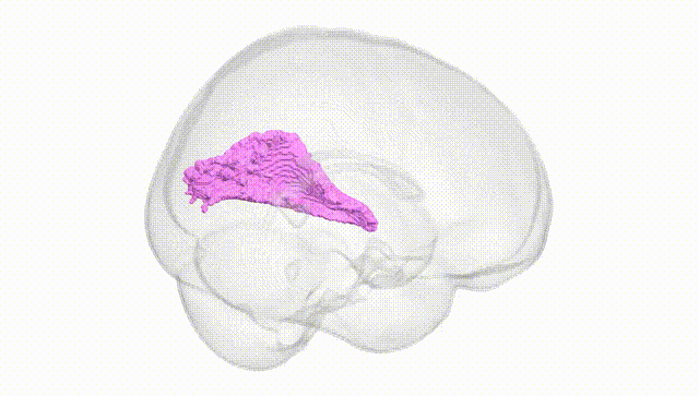 Full Brain White