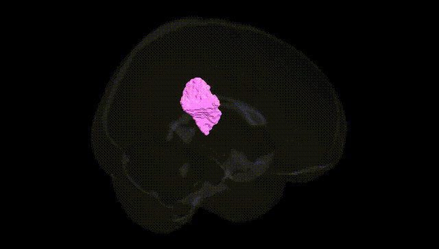 Full Brain Black