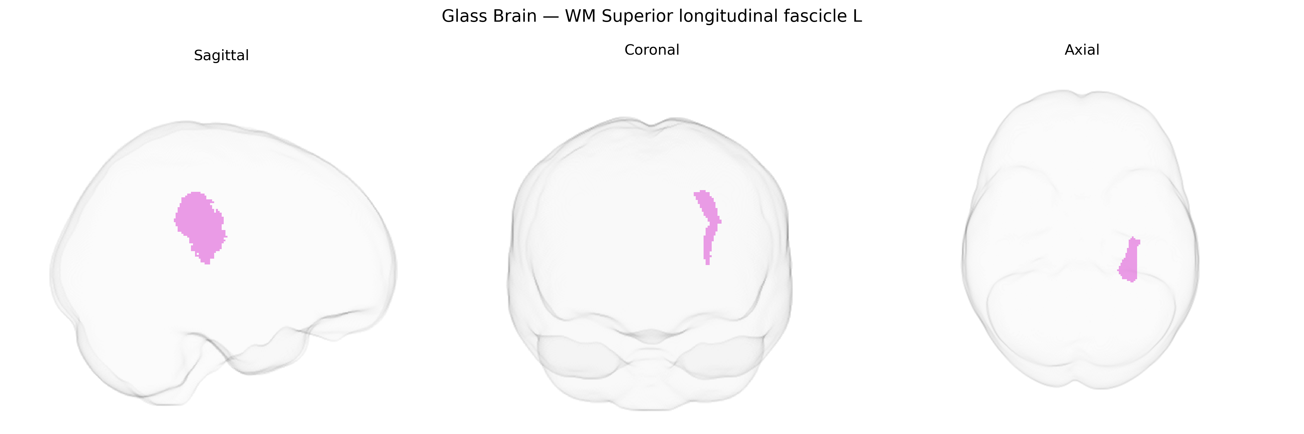 Triplanar Ghost Brain