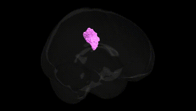 Full Brain Black