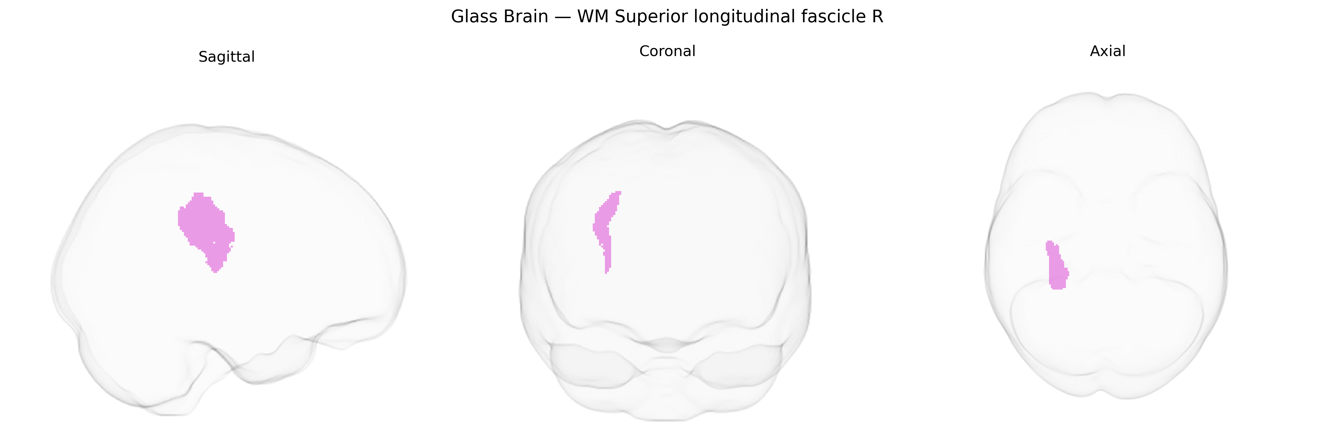 Triplanar Ghost Brain