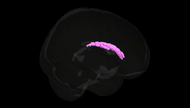 Full Brain Black