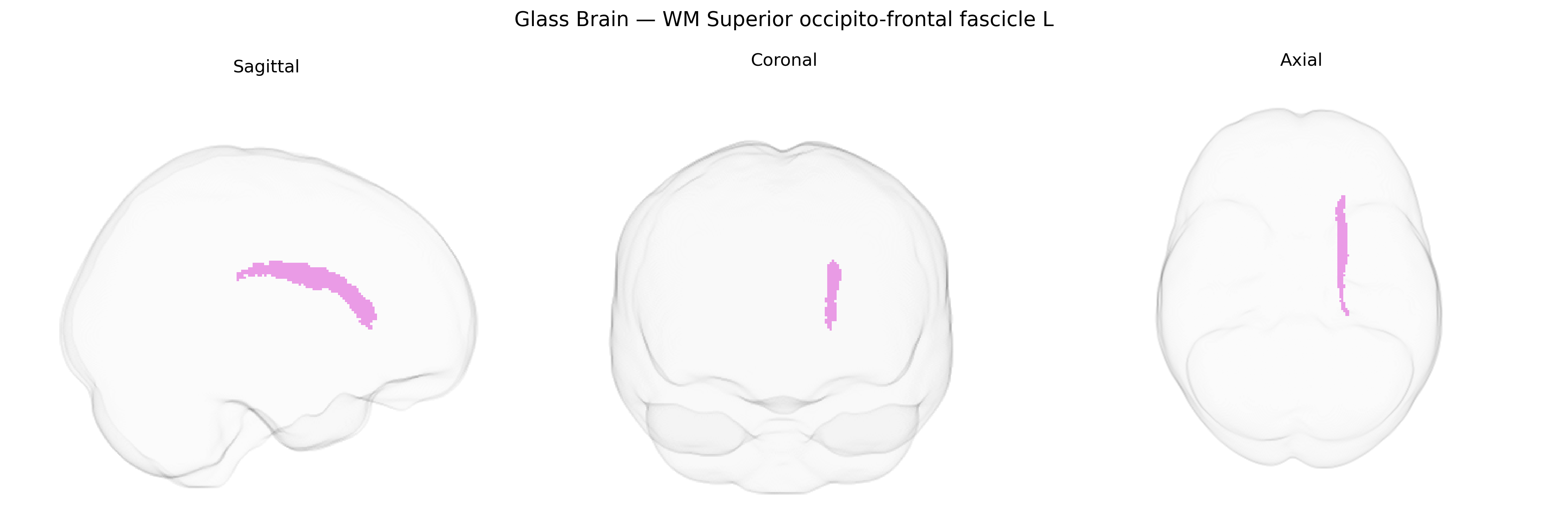 Triplanar Ghost Brain