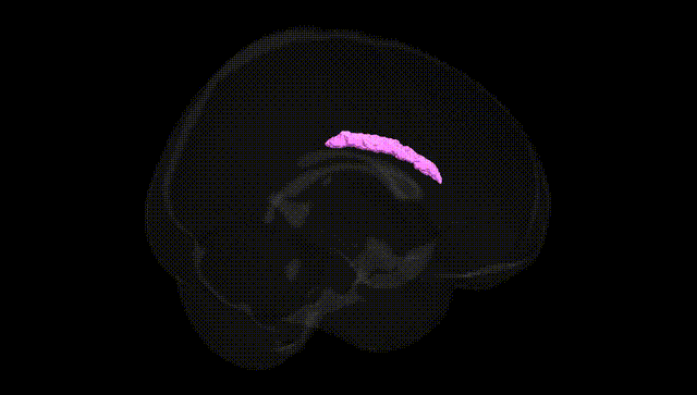 Full Brain Black