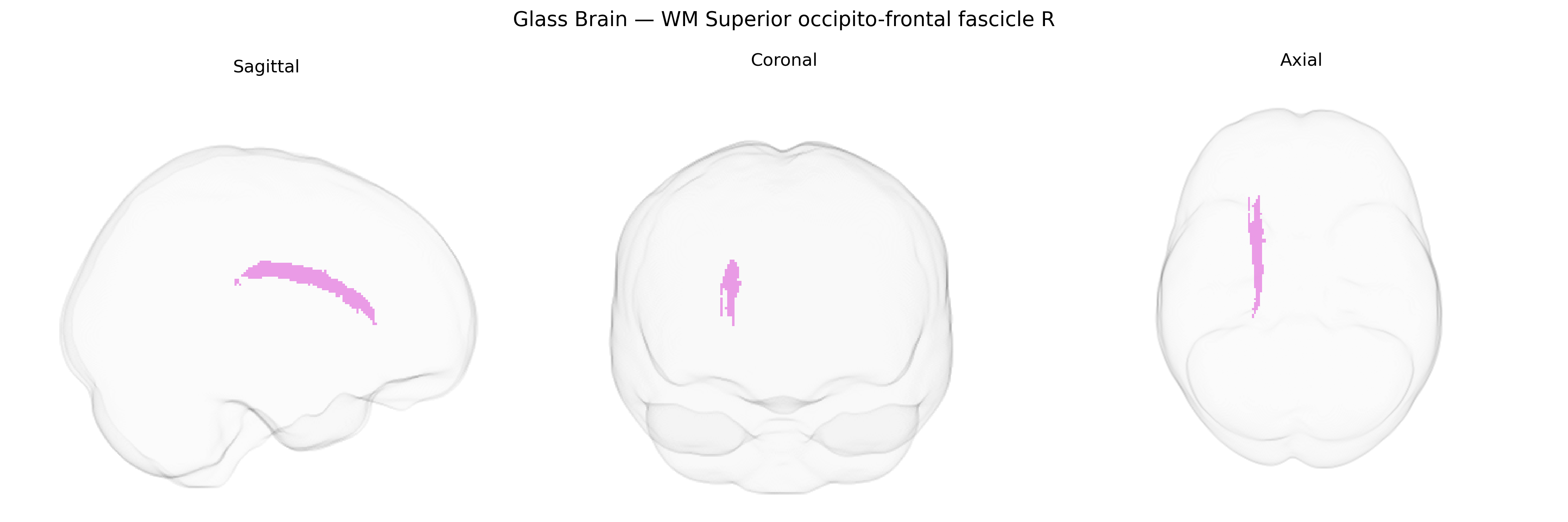 Triplanar Ghost Brain
