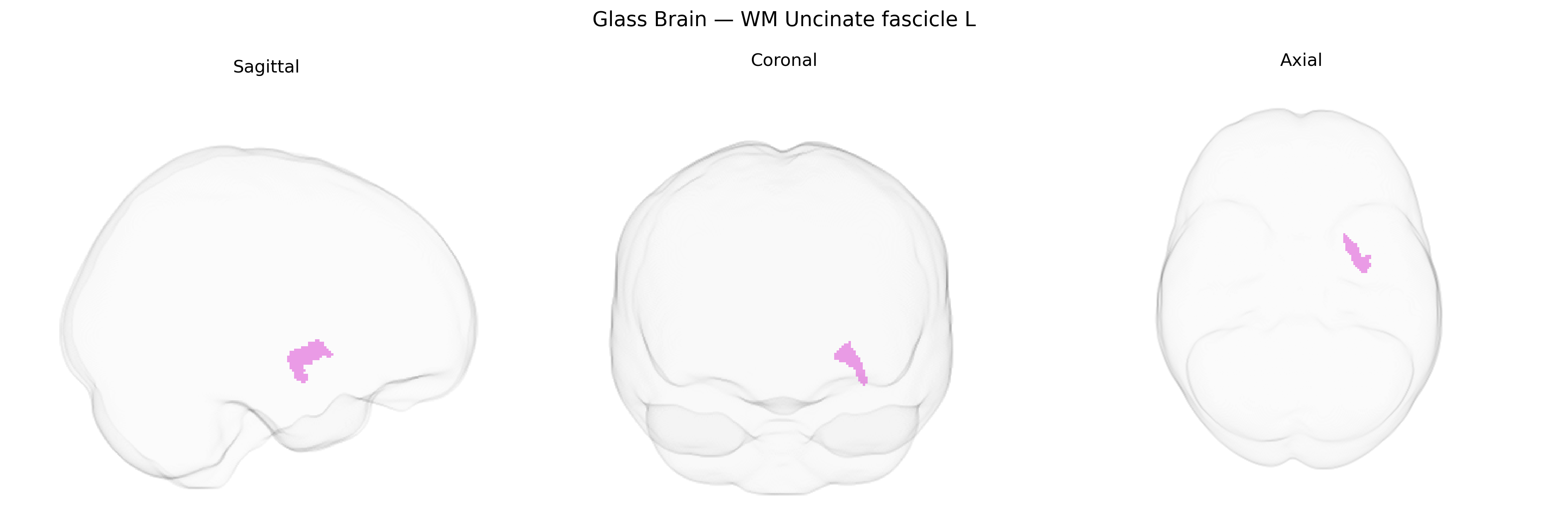 Triplanar Ghost Brain