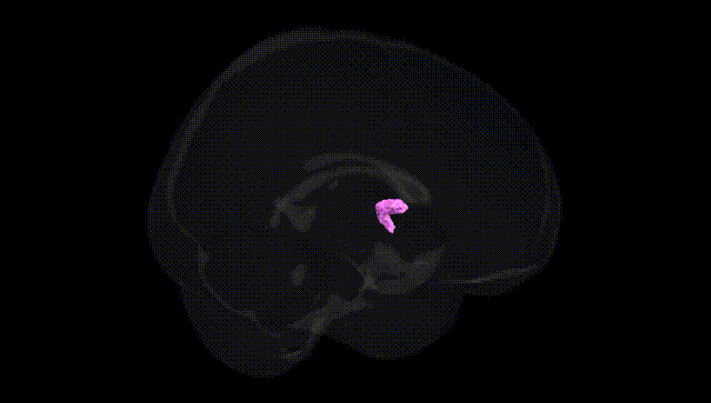 Full Brain Black