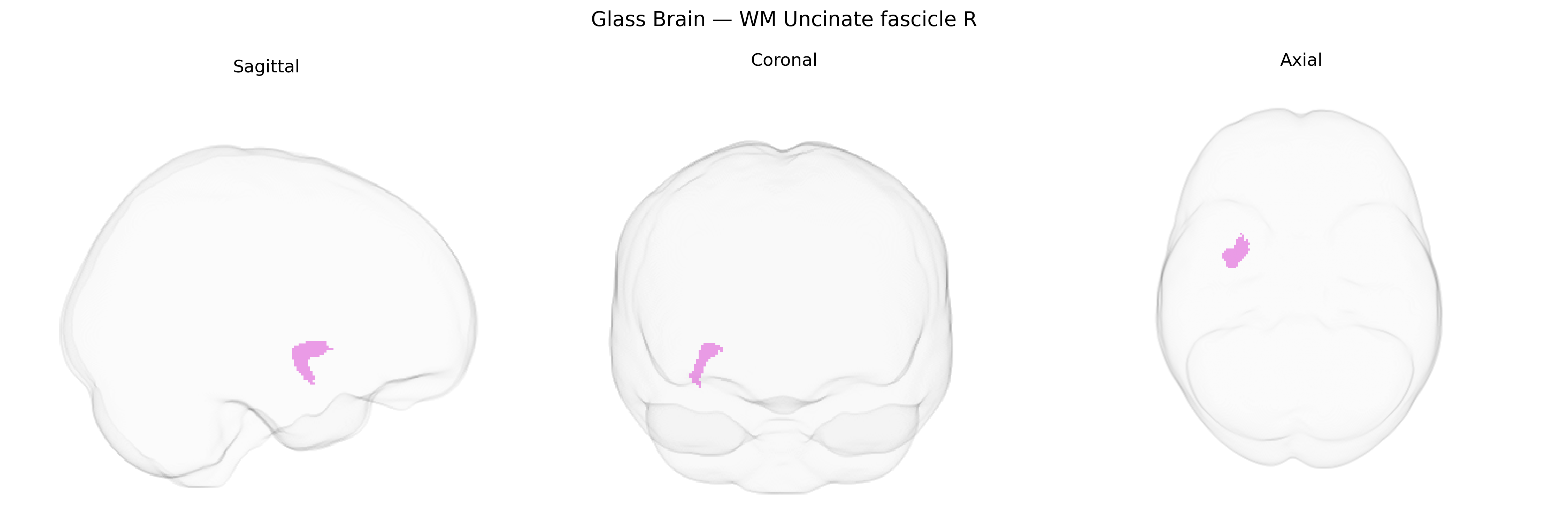 Triplanar Ghost Brain