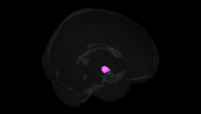 Full Brain Black