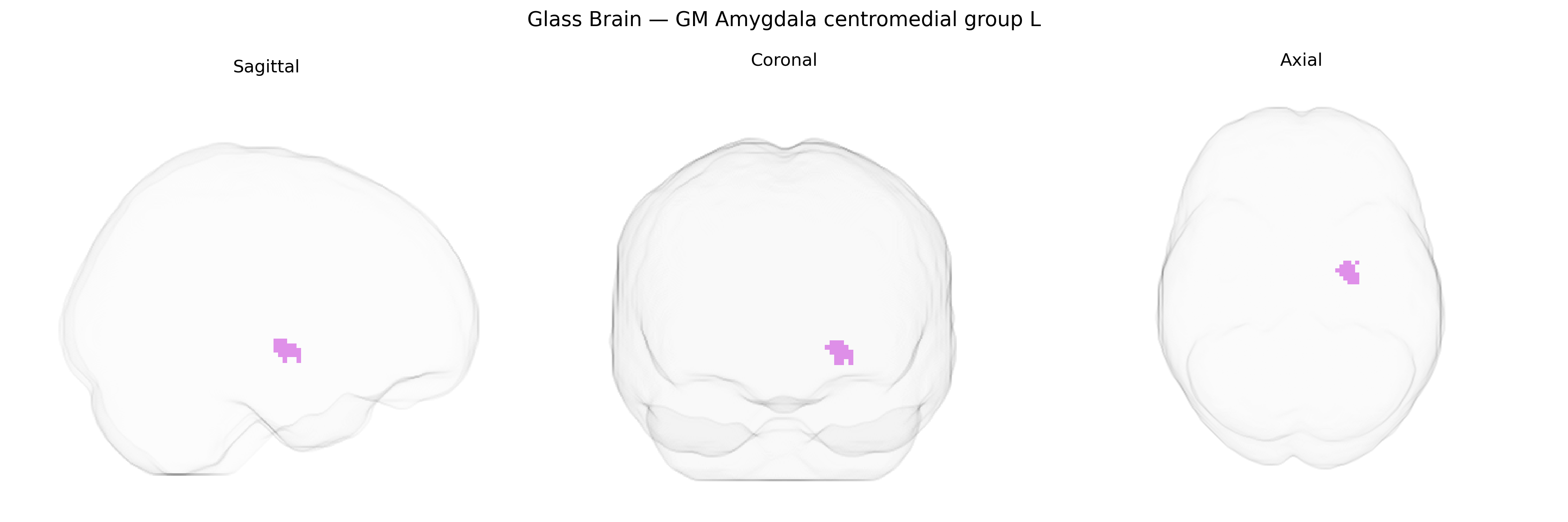 Triplanar Ghost Brain