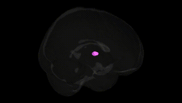 Full Brain Black