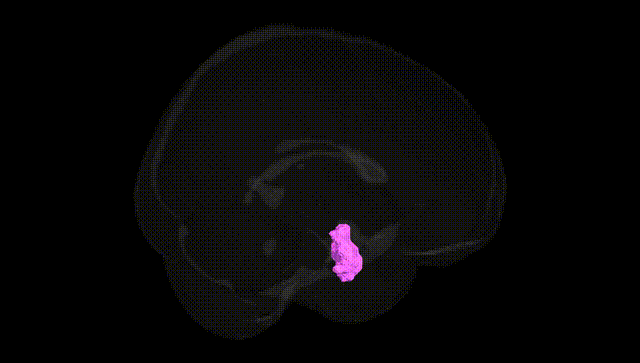 Full Brain Black