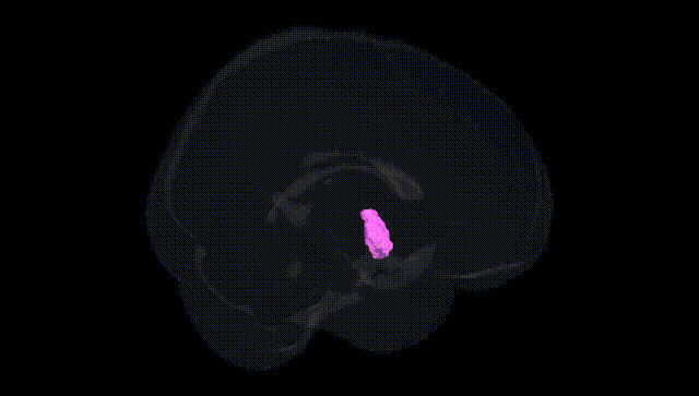 Full Brain Black