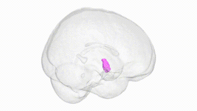 Full Brain White