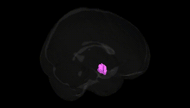 Full Brain Black