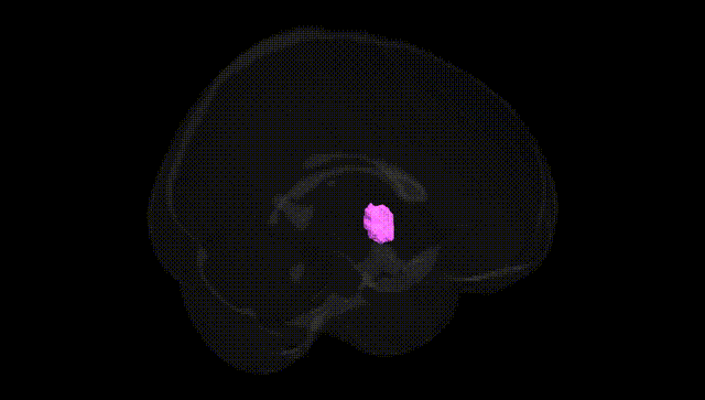 Full Brain Black