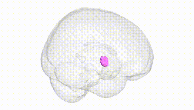 Full Brain White