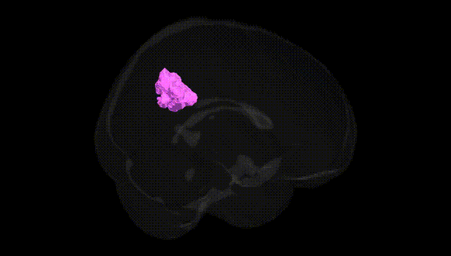 Full Brain Black