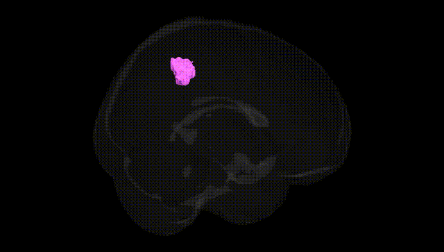 Full Brain Black