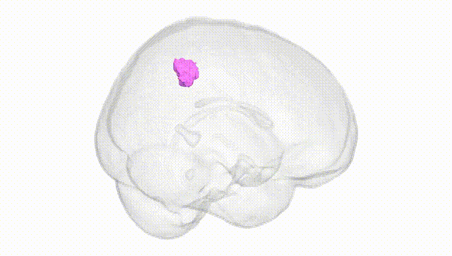 Full Brain White