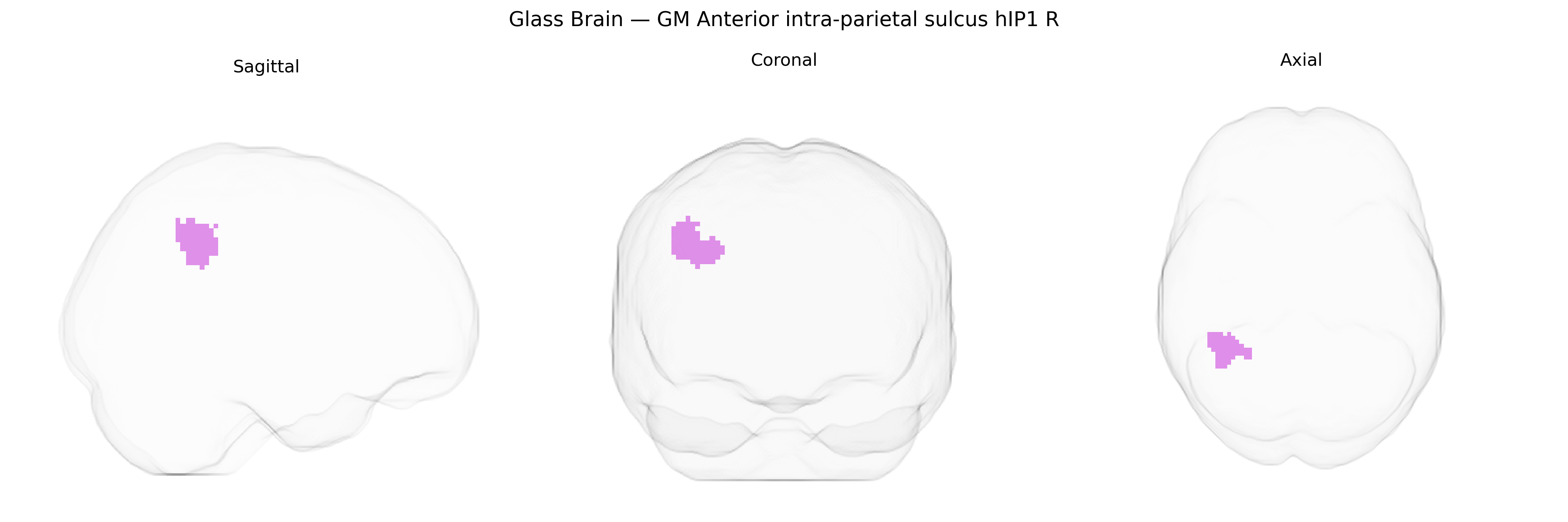 Triplanar Ghost Brain