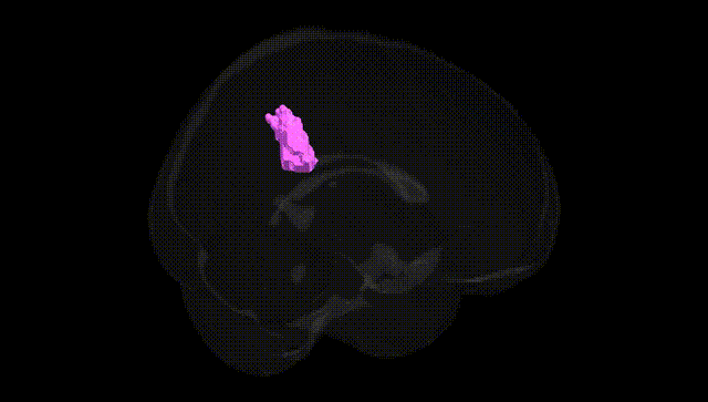 Full Brain Black