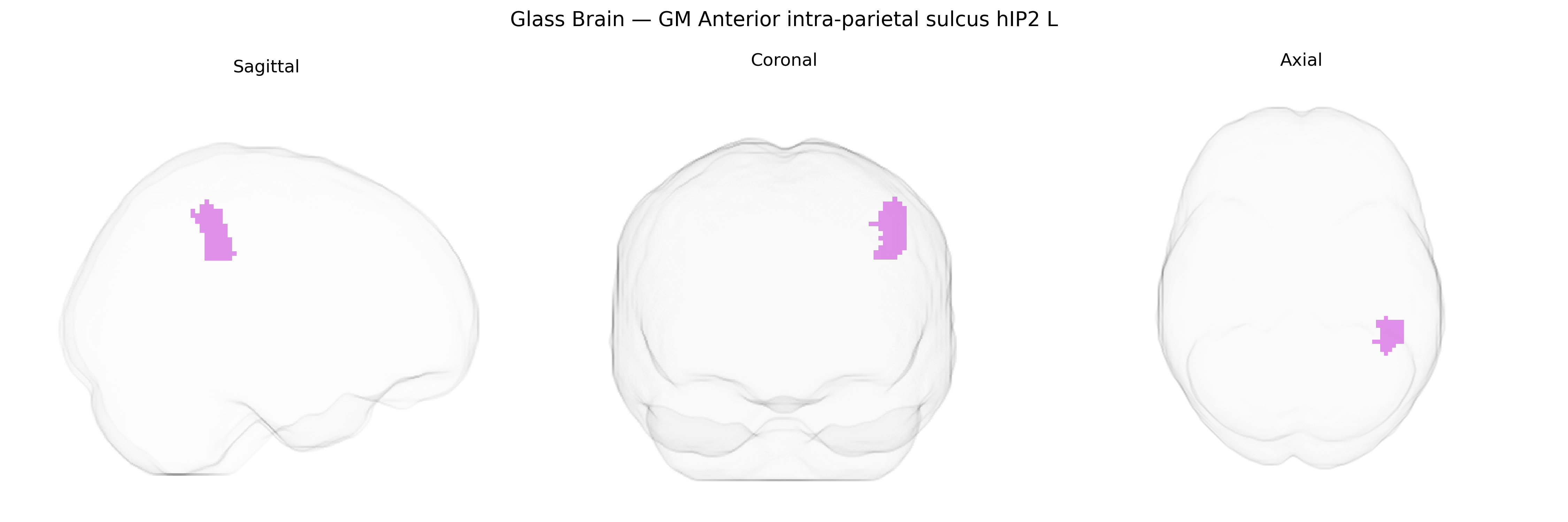 Triplanar Ghost Brain