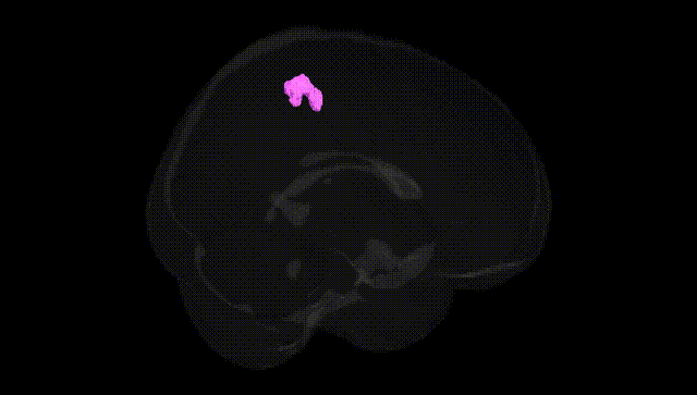 Full Brain Black