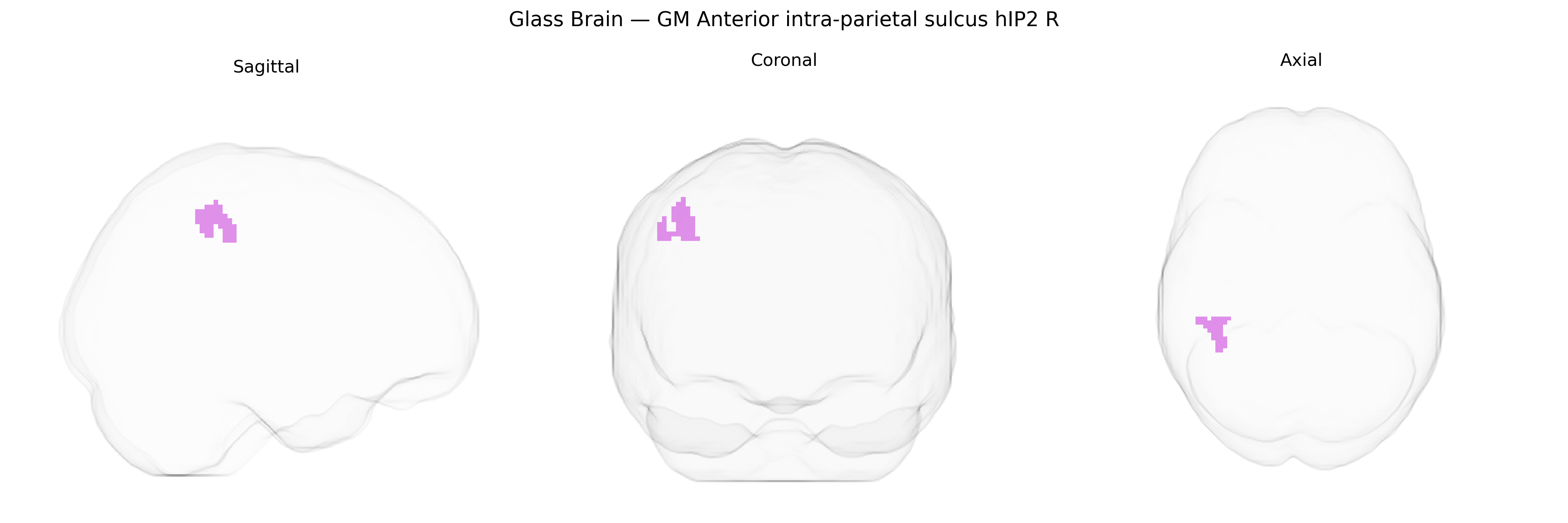 Triplanar Ghost Brain