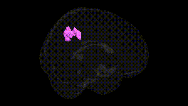 Full Brain Black