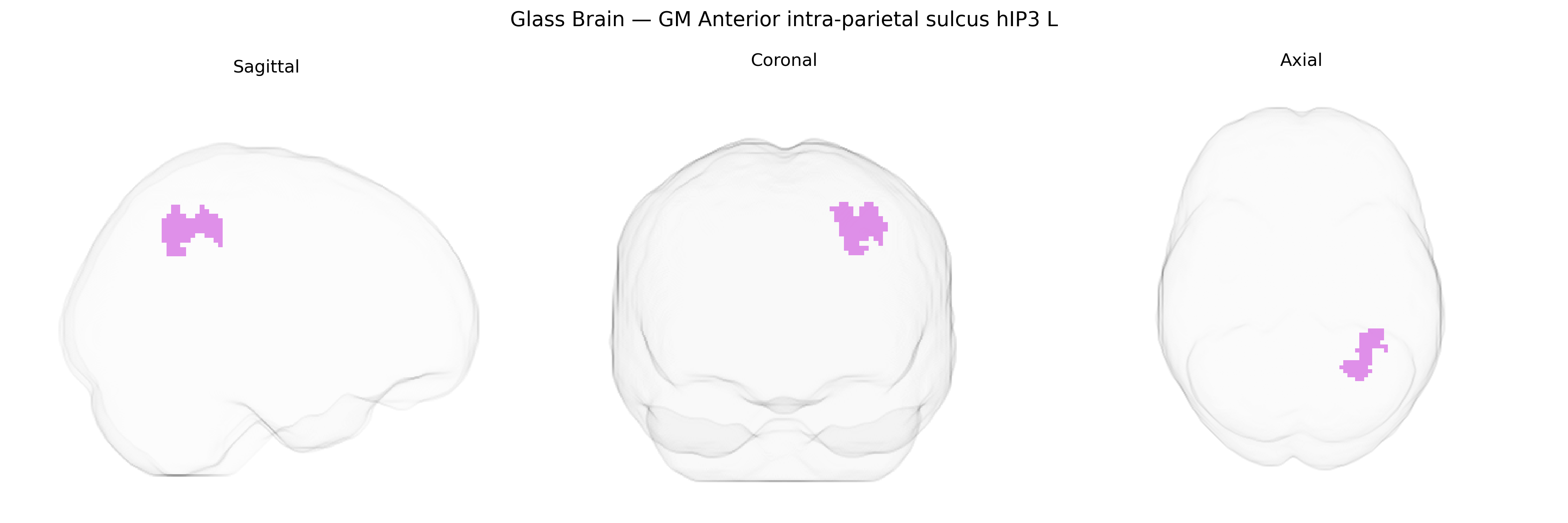 Triplanar Ghost Brain