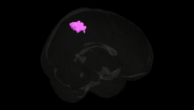 Full Brain Black