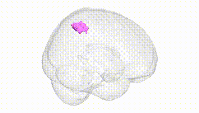Full Brain White