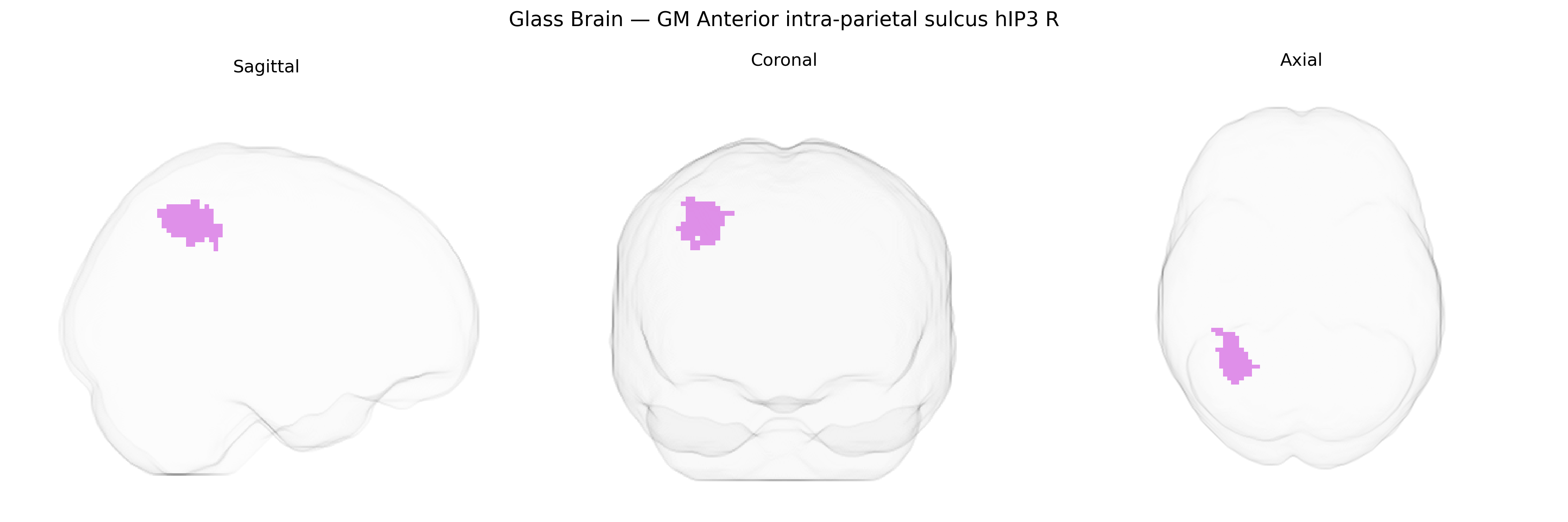 Triplanar Ghost Brain