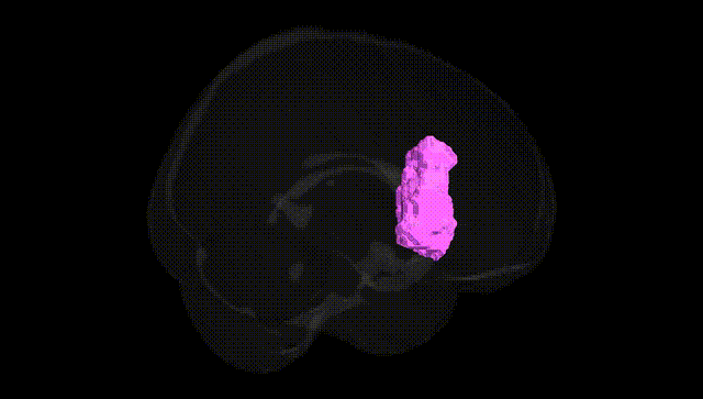 Full Brain Black