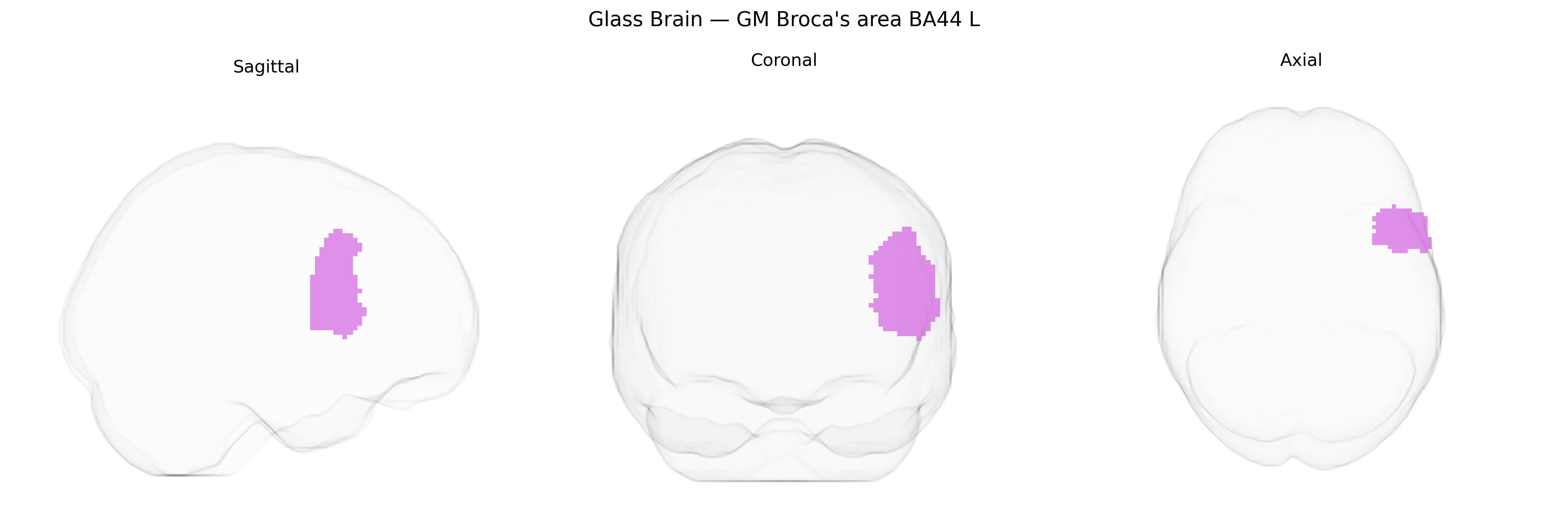 Triplanar Ghost Brain