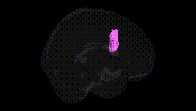 Full Brain Black