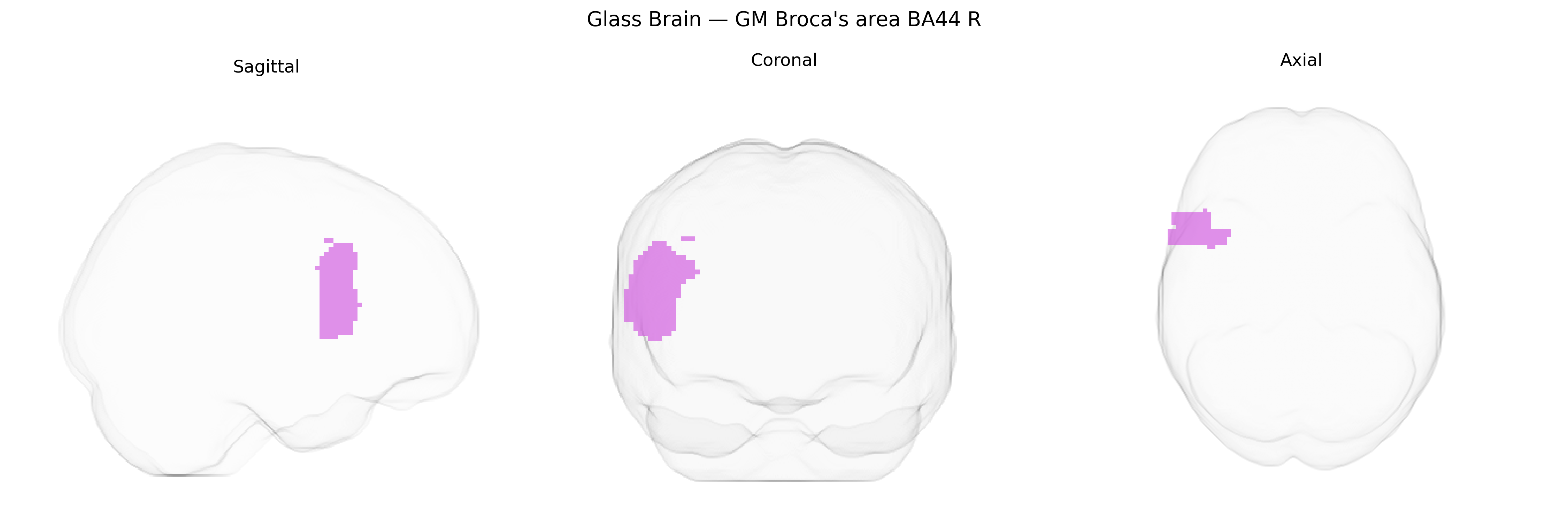 Triplanar Ghost Brain