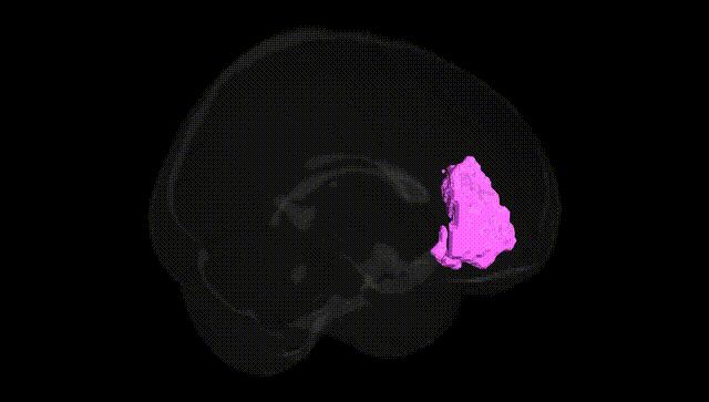 Full Brain Black